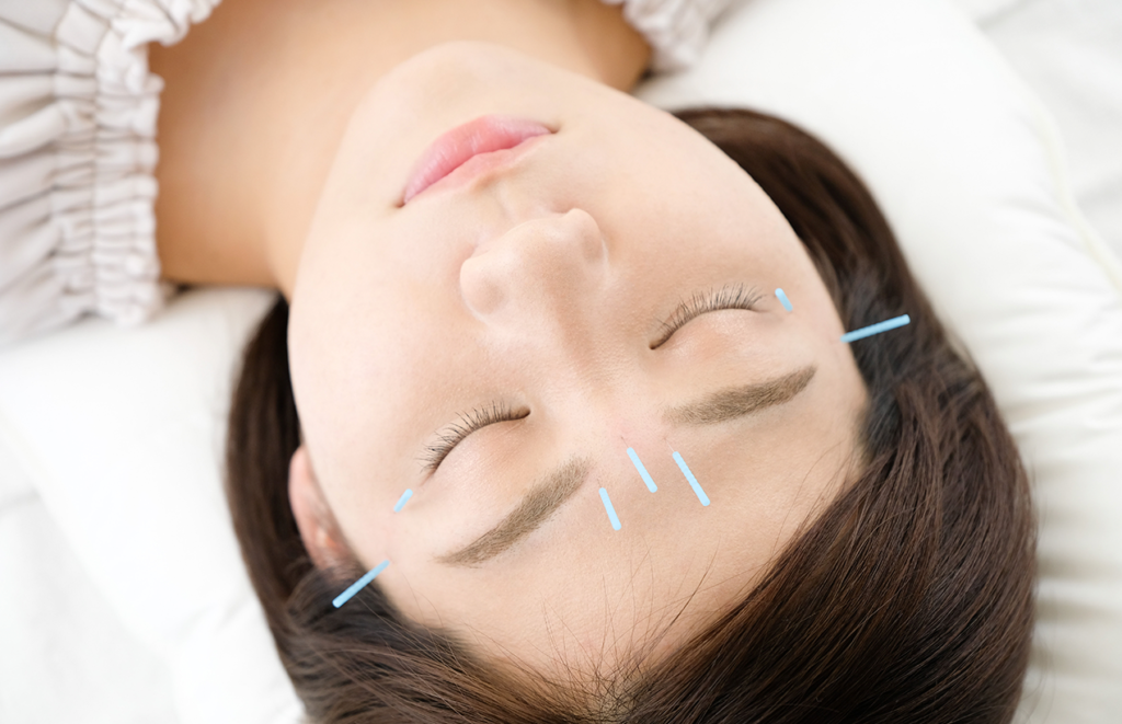 Craniopuntura de Yamamoto: Aplicações em Saúde Mental e Bem-Estar