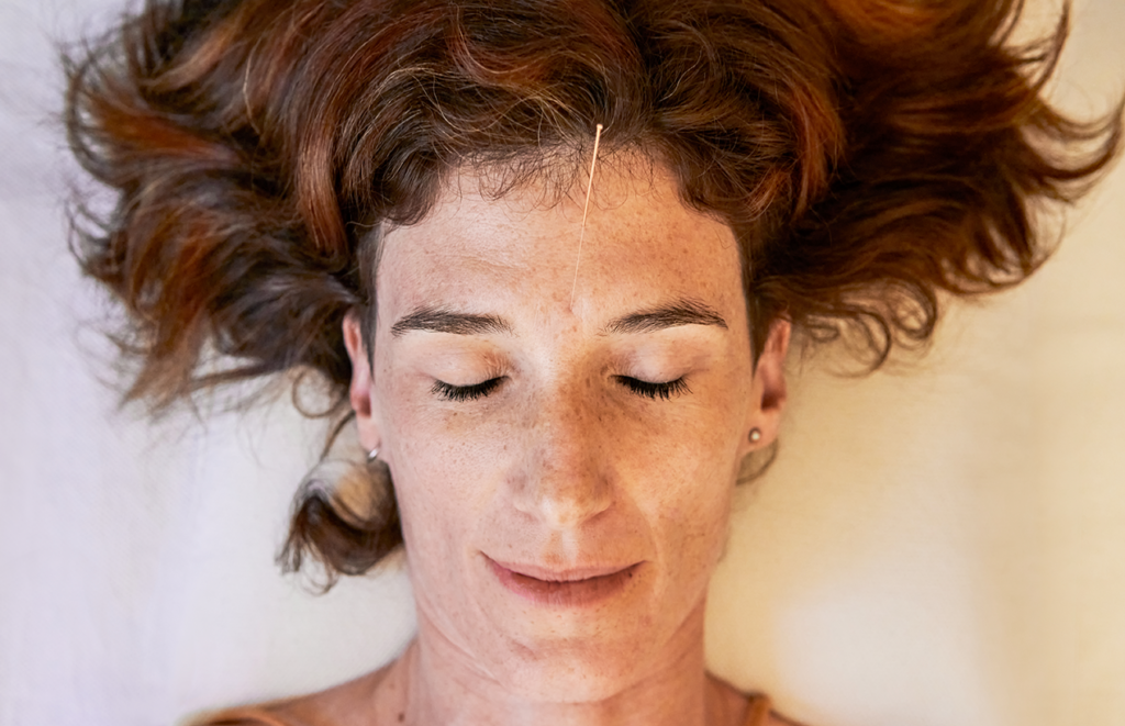 Introdução à Craniopuntura de Yamamoto: Princípios e Benefícios