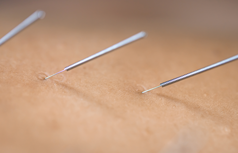 o-papel-do-shiatsu-e-da-acupuntura-na-reducao-do-estresse-e-ansiedade